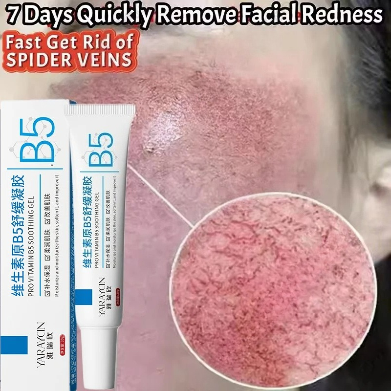 Coenzyme Q10 Cream - 얼굴 붉음증 개선 크림 민감성 피부