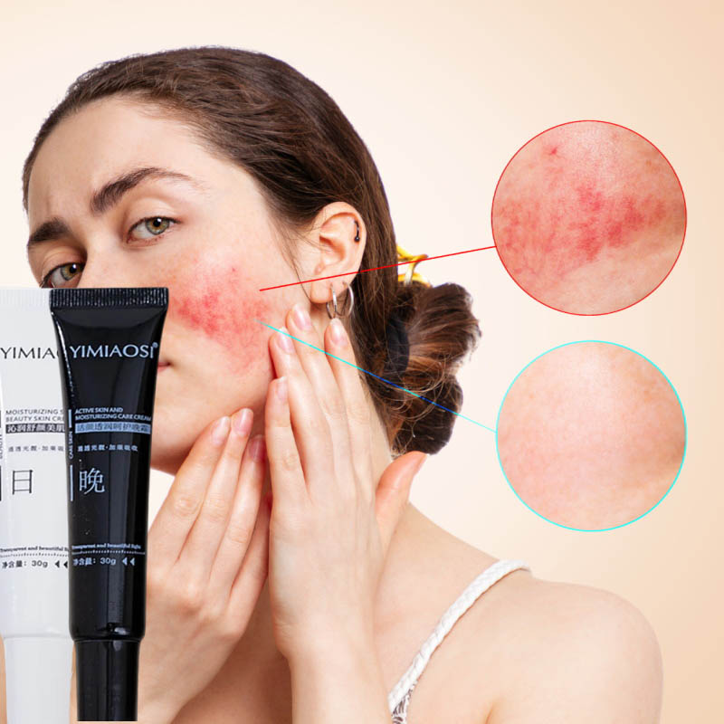 Coenzyme Q10 Cream - 얼굴 홍조 개선 크림 민감성 피부