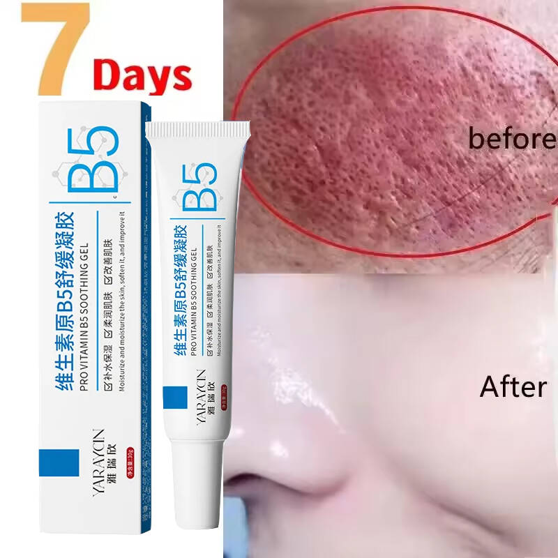 얼굴 붉음증 개선 크림 민감성 피부 건조 개선 보습 진 - Coenzyme Q10 Cream 리뷰 및 가격