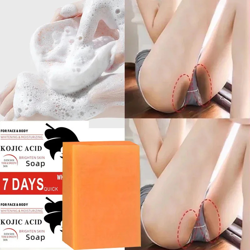 코직산 바디 화이트닝 비누 딥 스킨 블리칭 브라이트닝  - Kojic Acid Soap 리뷰 및 가격
