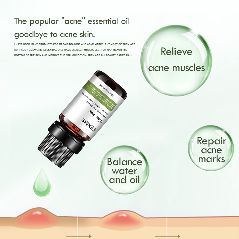 100% 순수 티 트리 에센셜 오일, 피부, 머리카락, - Tea Tree Spot Treatment 리뷰 및 가격