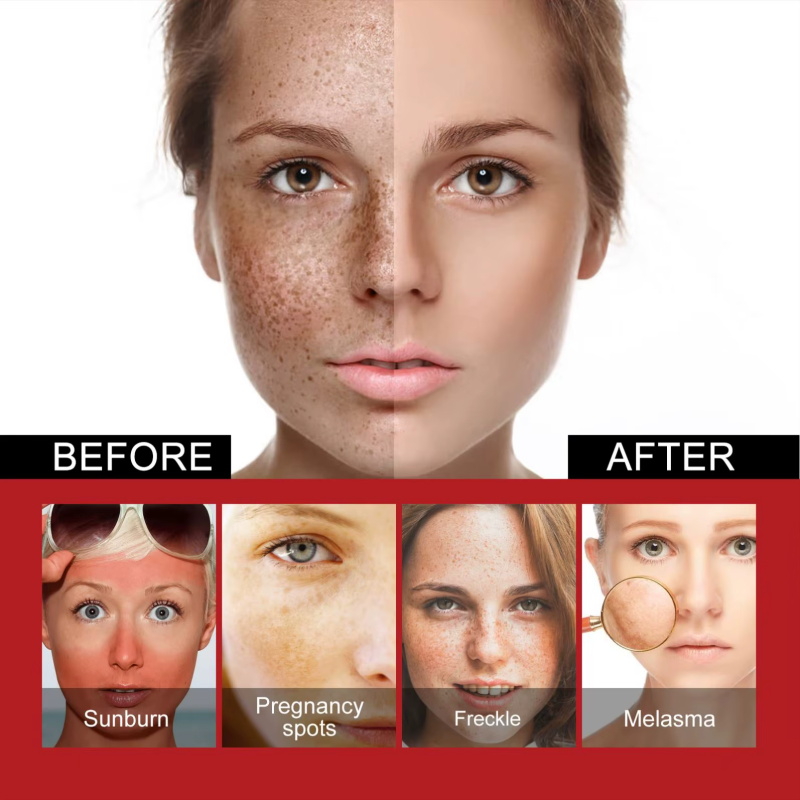 강력한 잡티 제거 화이트닝 크림, 피부를 빠르게 밝게  - Coenzyme Q10 Cream 리뷰 및 가격